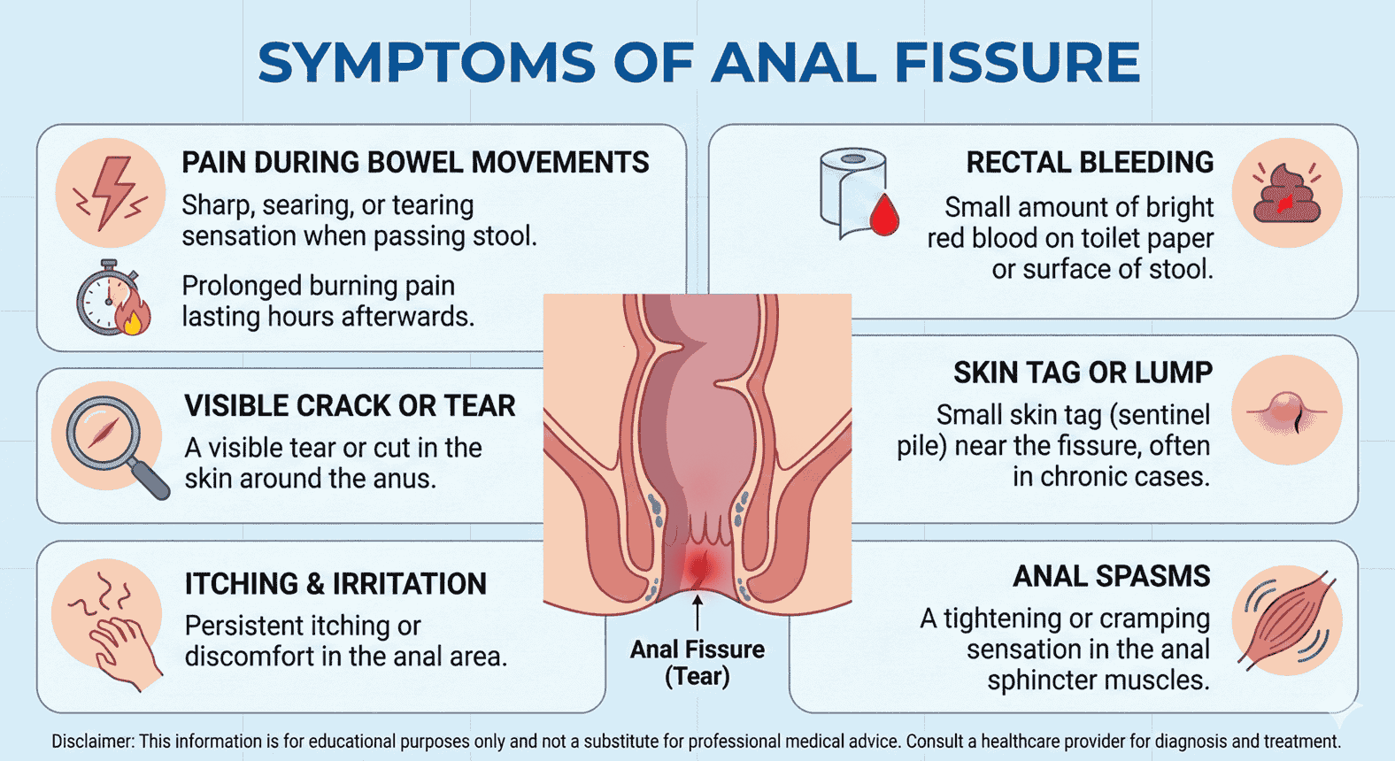 Anal Fissure Symptoms Causes Types Complications Prevention anal-fissure-symptoms-causes-types-complications-prevention